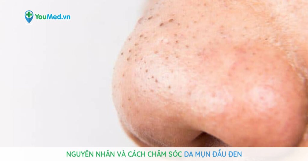 * chăm sóc da sau nặn mụn phục hồi cân bằng * chăm sóc da sau nặn mụn phục hồi cân bằng