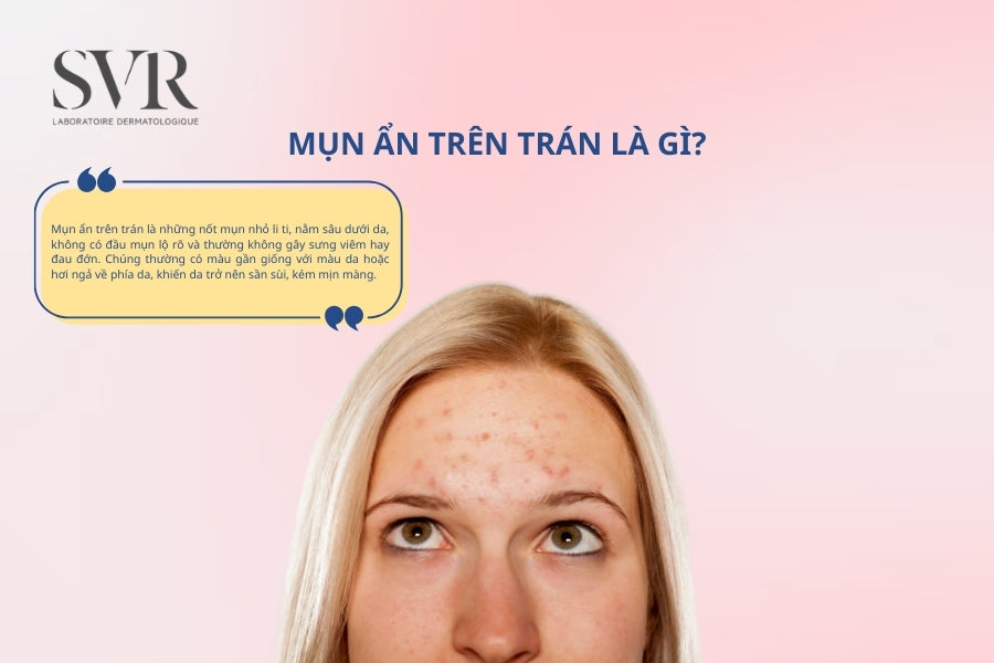 mụn ẩn dấu hiệu nhận biết