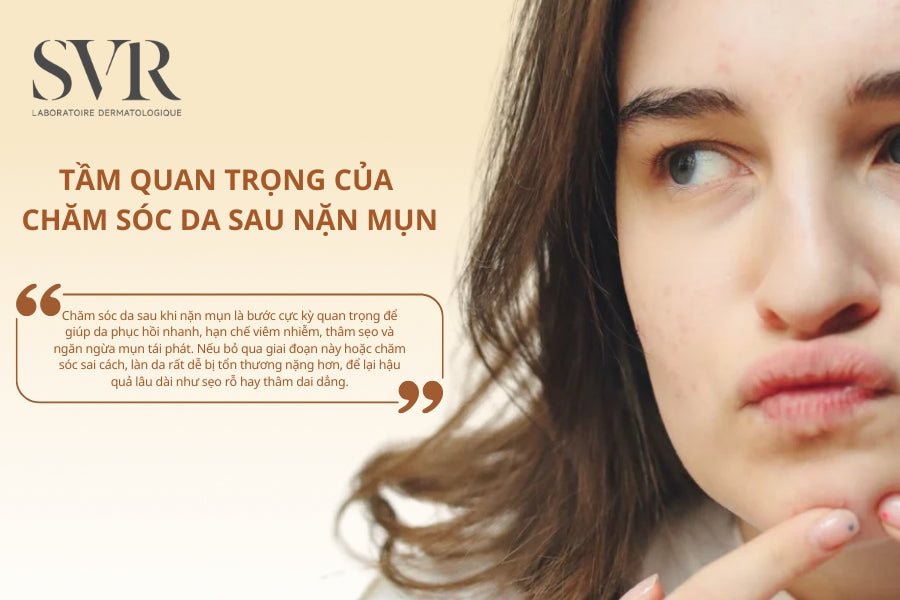 Chà xát da mạnh khăn mặt gây mụn Chà xát da mạnh khăn mặt gây mụn