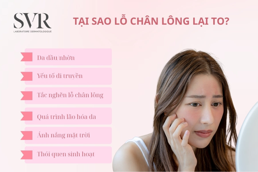 bít tắc lỗ chân lông mụn bít tắc lỗ chân lông mụn