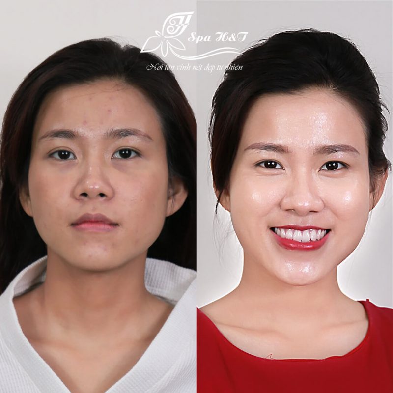 wax ria mép wax ria mép