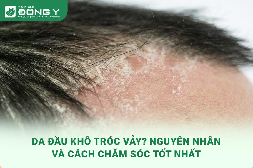 Quy trình chăm sóc da khô mùa hanh