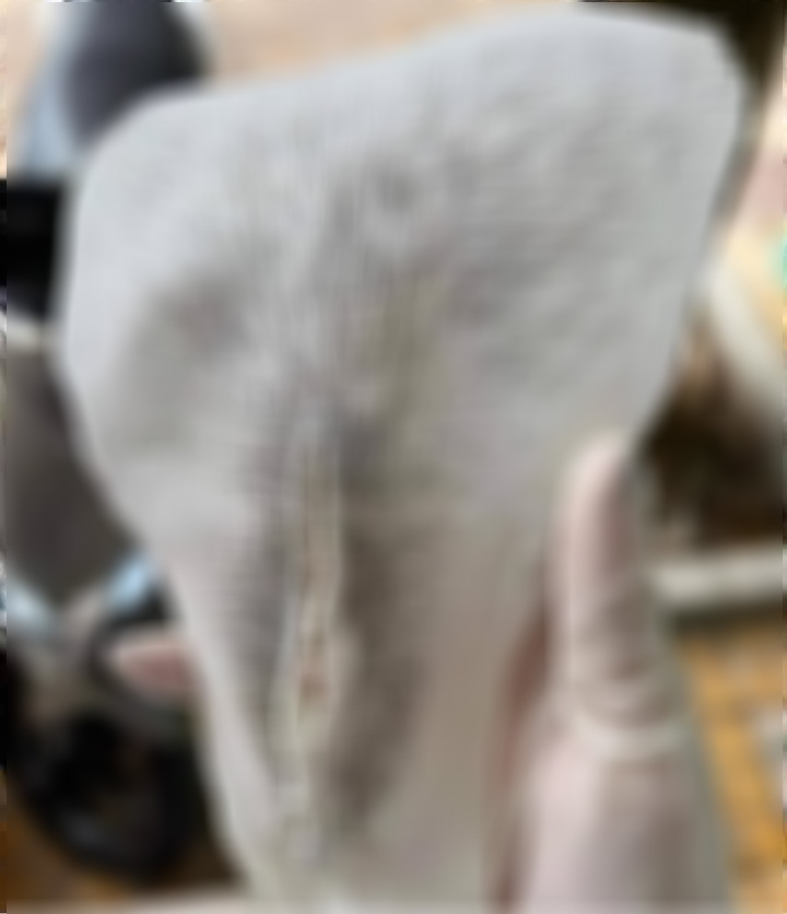 spa triệt lông làm sạch da spa triệt lông làm sạch da