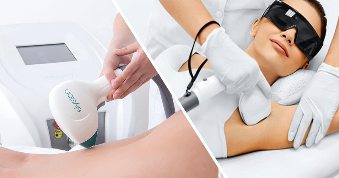So sánh diode laser và IPL triệt lông
