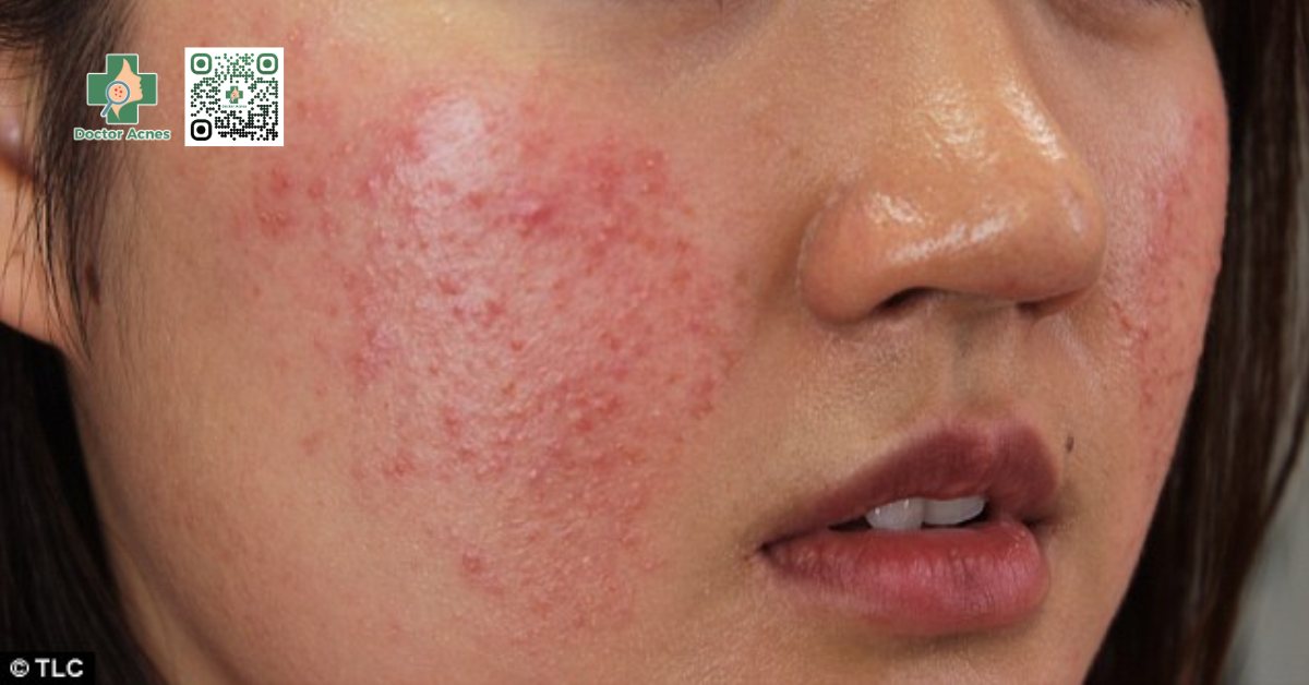 Dị ứng mỹ phẩm dấu hiệu Dị ứng mỹ phẩm dấu hiệu