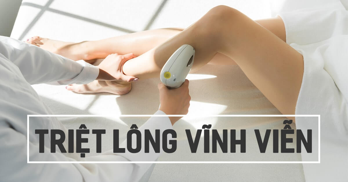 Triệt lông vĩnh viễn